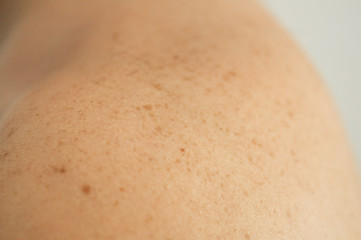 Close up detail of the bare skin on a man back with scattered moles and freckles. Checking benign moles. Sun effect on skin. Birthmarks on skin