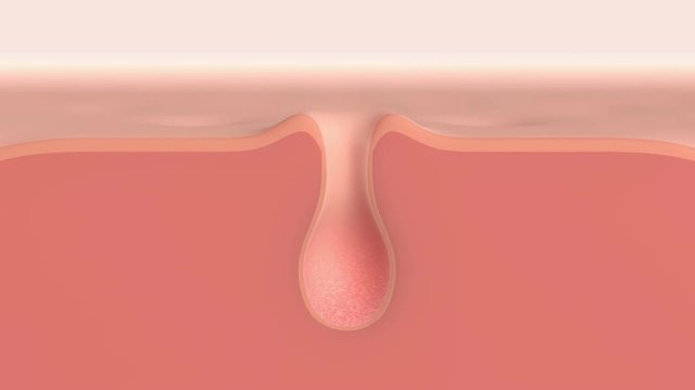 3D animation of a skin pore cleaning demo