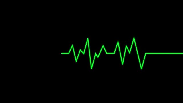 Animated heart monitor EKG line