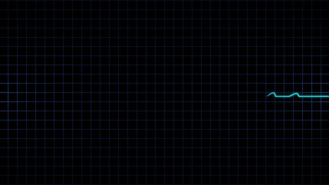Electrocardiogram animation heart pulse