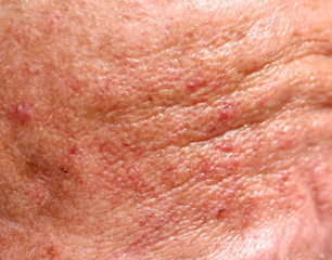 Fototapeta premium The skin of an old man as a background