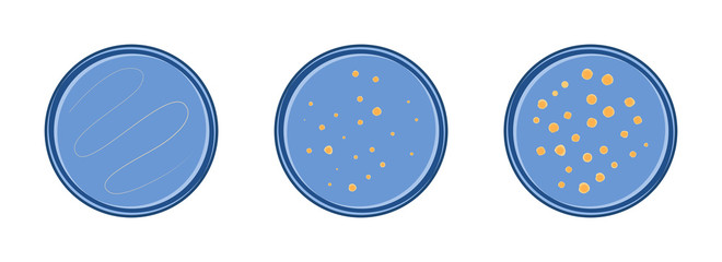 Microbiology. Colony bacteria growth in petry dish, 3 stages, vector flat style.