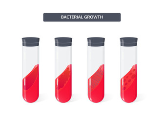 Growth of bacterial colonies in test tubes on a sloping nutrient medium. Types of colonies in form. Vector concept for microbiology theme.