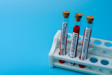 Cholesterol test Hepatitis Test and liver Enzyme Test, in Vitro.