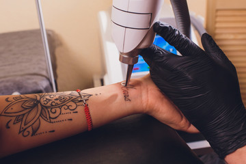 Cosmetologist with patient and professional tattoo removal laser in salon.