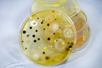 Colonies of different bacteria and mold fungi grown on Petri dish with nutrient agar, close-up view. Microbiology background