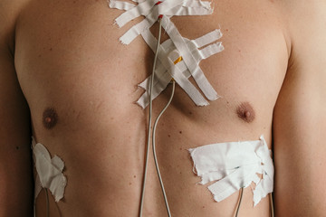 Man wearing mobile holter cardio monitor