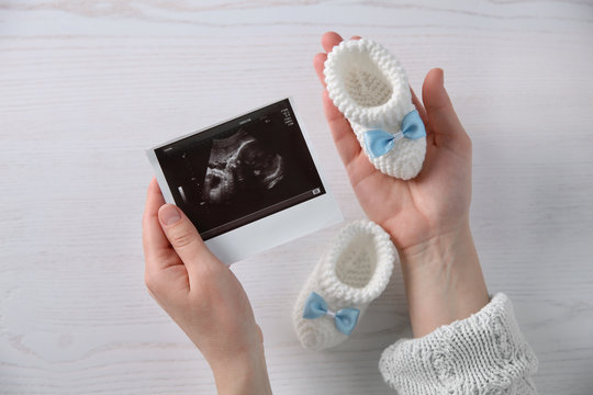 Woman holding ultrasound photo of baby and knitted boots over table, top view