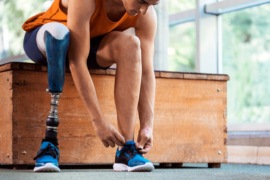 Disabled man athlete ready for training with leg prosthesis.