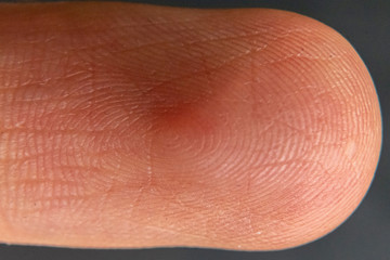 close up macro photo of a finger print of a caucasian man b