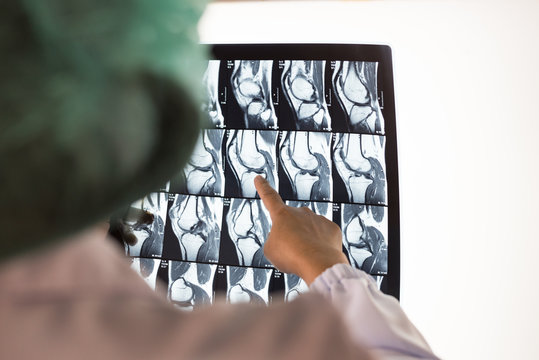 Seriously woman doctor holding and pointing patient bone x-ray film before surgery treatment.Image MRI and CT scan at radiology department in hospital.Knee join x-ray for treatment.Selective focus.