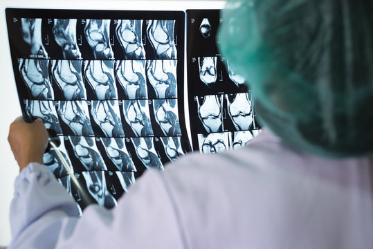 Seriously woman doctor holding and pointing patient bone x-ray film before surgery treatment.Image MRI and CT scan at radiology department in hospital.Knee join xray for treatment.Selective focus. - Powered by Adobe