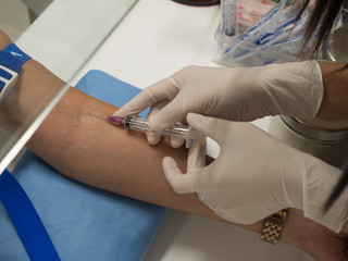 Close up nurse pricking needle into the patient arm for blood chemistry test.Laboratory with technician collecting a blood sample from patient.Medical analysis concept