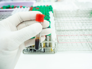 Scientist hand holding blood test tube and plasma ready for laboratory analysis.Medical equipment for blood testing concept