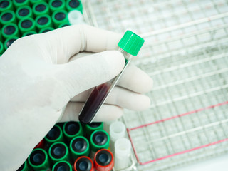 Scientist hand holding blood test tube and plasma ready for laboratory analysis.Medical equipment for blood testing concept