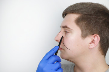 A man at the reception at the plastic surgeon. Before nose surgery, rhinoplasty