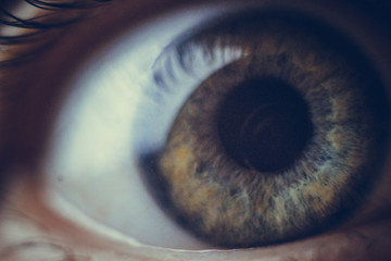 macro eyes with bursting red blood vessels. eyeball covered with blood close up. vision problems....