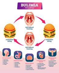Bulimia vector illustration. Labeled self induced vomiting diagnosis scheme