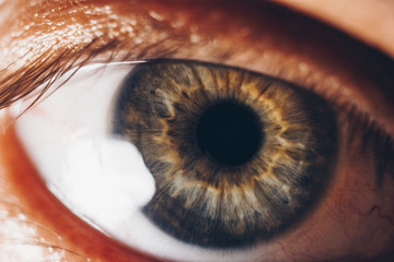 macro eyes with bursting red blood vessels. eyeball covered with blood close up. vision problems....