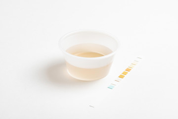 A combination of urine sample in a small round plastic container with a urine reagent strip deliberately and artistically set on a plain white background.