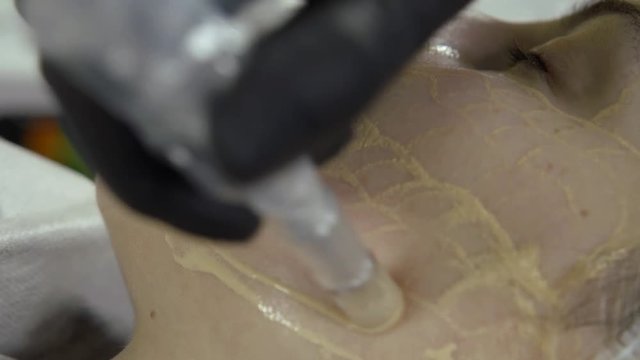 Cheek girls closeup. It hammered microinjection of Foundation.