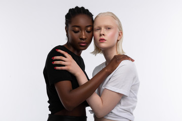 Obraz premium Woman with white skin touching shoulder of her African-American friend