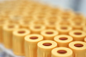 macro of test tubes with yellow top, against a gradient of white background. Selective focus