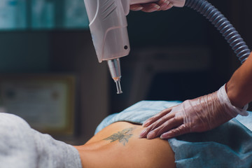 Cosmetologist with patient and professional tattoo removal laser in salon.