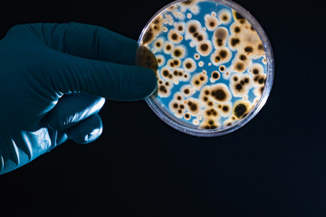 petri dish with microbe colony in doctor hand