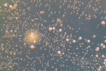 Colonies of fungi and bacteria on agar in a petri dish