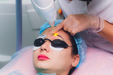 Laser removal of a permanent make-up on a face. Closeup young woman receiving correction of a...