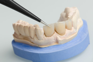 Fototapeta na wymiar work with tweezers at dental imprint with artificial dentition in a dental laboratory