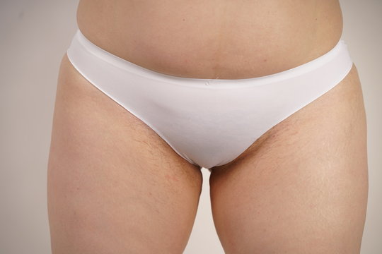 plus size overweight woman with stretches marks on her skin and a hairy crotch standing in white sporty lingerie. female thick hips closeup. unkempt plump girl.