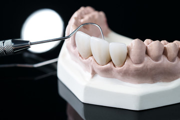 porsthodontic model and dentist tool - demonstration teeth model of varities of porsthodontic...