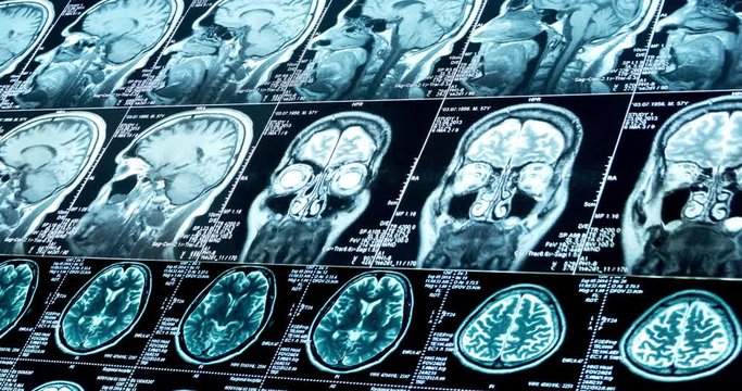 MRI scans of various sizes are moving diagonally, looped