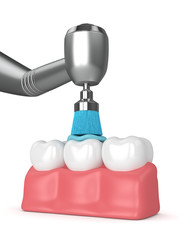 Fototapeta premium 3d render of teeth with dental handpiece and polishing brush
