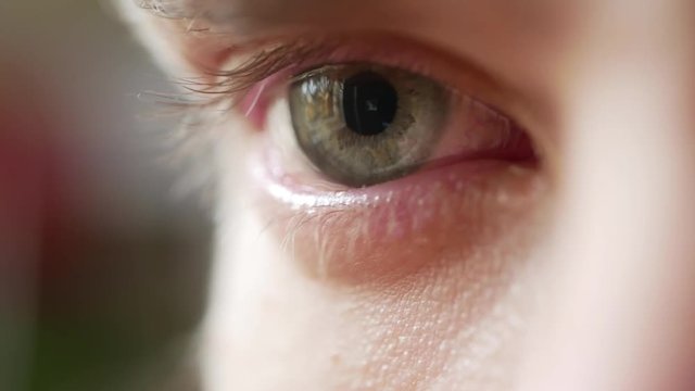 Eye irritated by onions and crying, closeup macro white male