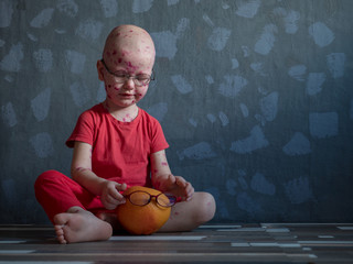 Funny blond child in glasses has chicken pox. Mom smeared follicles with pink solution of takkelani...