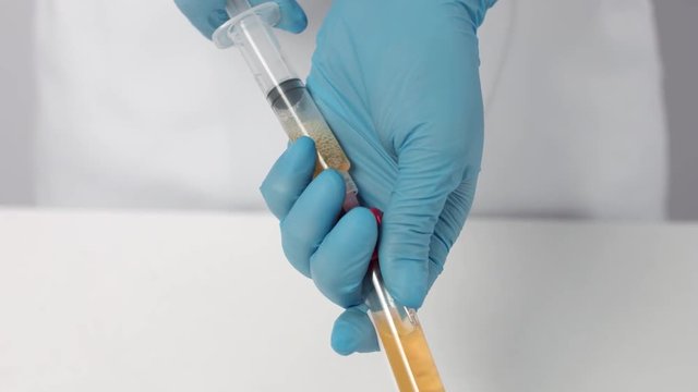 Process of picking up blood plasma from flask in the syringe