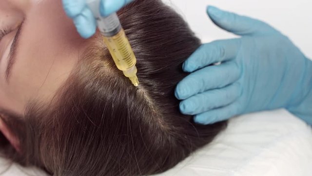 Plasma injections for hair growth | young brown-haired woman