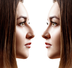 Young woman in profile before and after rhinoplasty. - 261918567