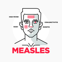 Measles Symptoms Infographic