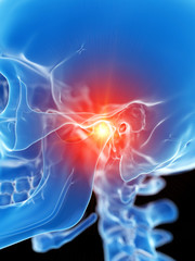 Fototapeta premium 3d rendered medically accurate illustration of the temporomandibuar joint showing pain
