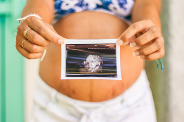 9 month Pregnant Woman