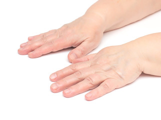 The hands of an elderly woman on a white background which has skin problems, irritation and redness on the skin, hypoallergenic, isolat, moisturizing