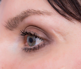 Fototapeta na wymiar deep scar on the skin of the girl on the face near the eye, close-up, treatment