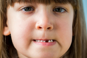 Portrait of adorable kid missing her first milk tooth.  Lifetime moments and happy childhood concept. Close up