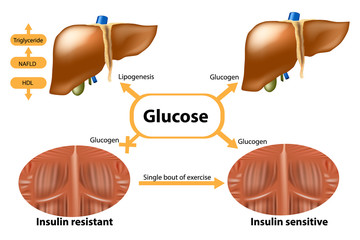 Glycogen in liver and muscle. Insulin sensitive and Insulin resistant. 
