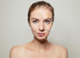 woman face portrait with clear and pimpled skin