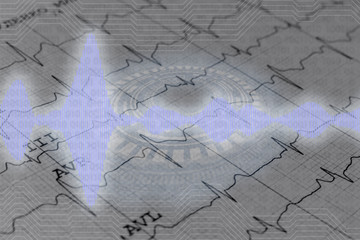 modern technology medicine analysis, 3d heartbeat projection b